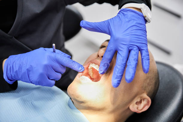 Best Chipped Tooth Repair Near Me  in Wink, TX